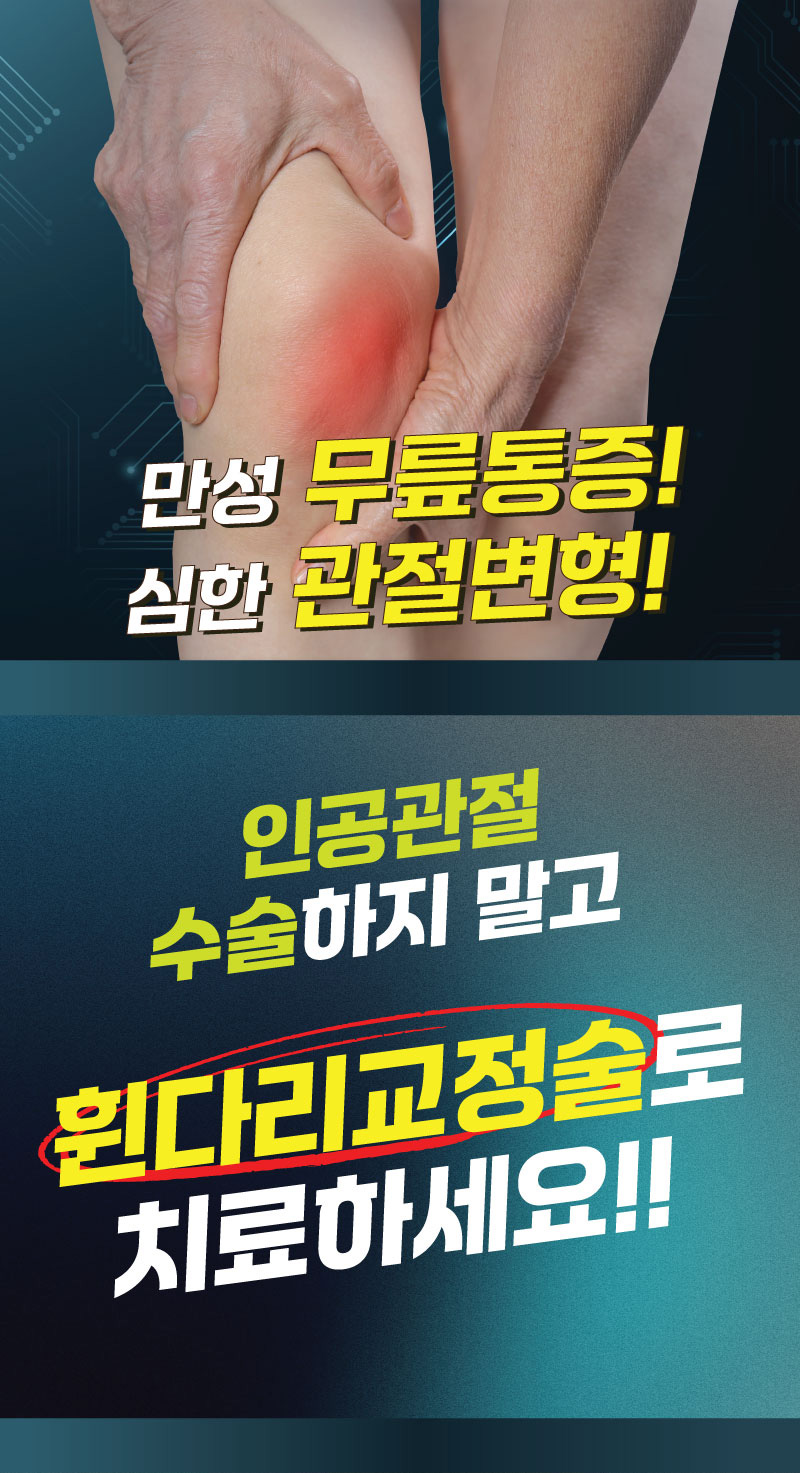 만성 무릎통증! 심한 관절변형! 인공관절 수술하지 말고 휜다리 교정술로 치료하세요!!