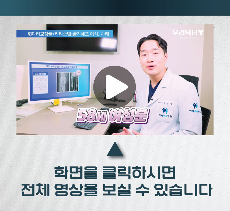 연골을 살리는 유일한 방법!!